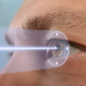 7 Hidden Costs of Cataract Surgery You Need to Know